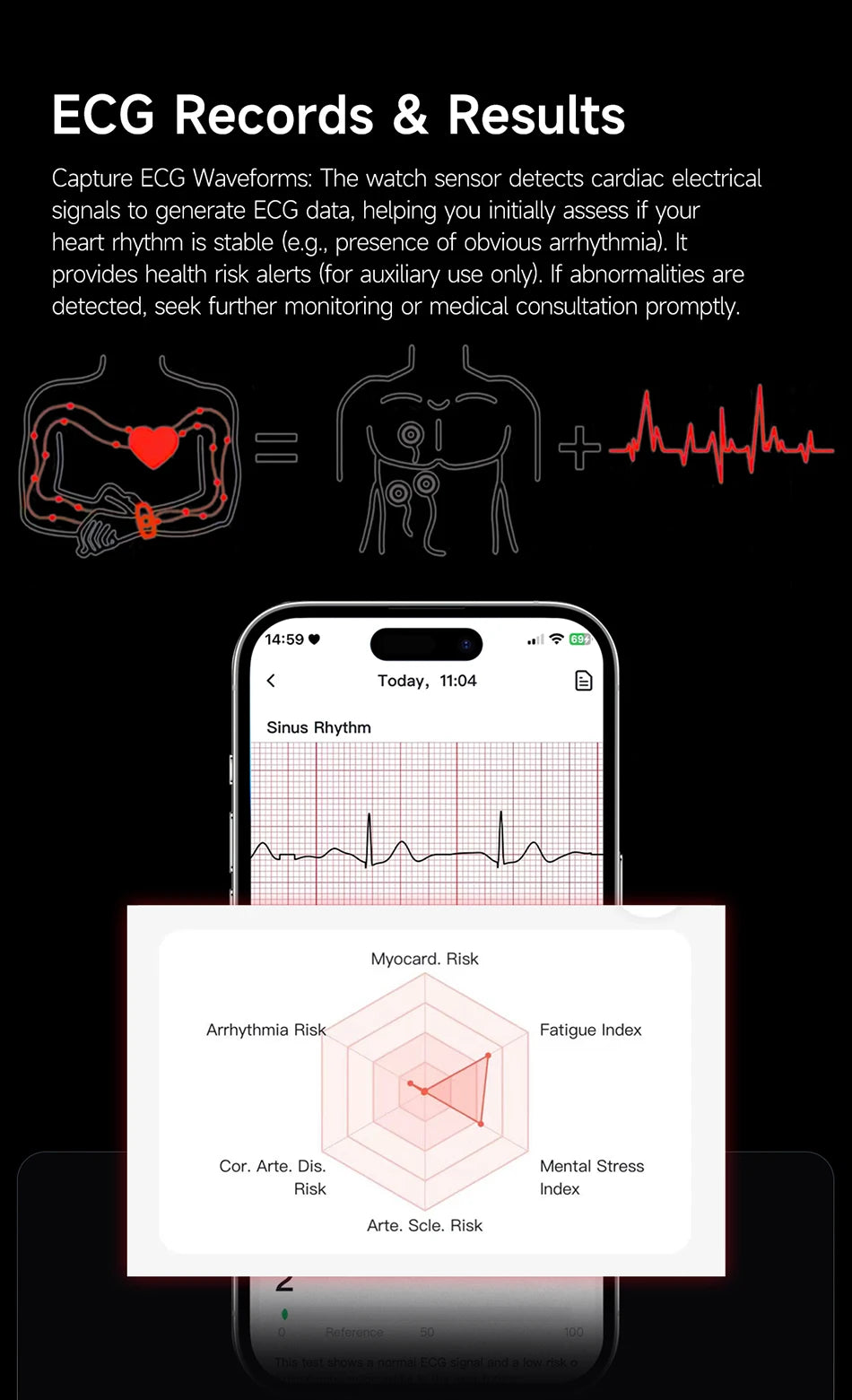 Nouvelle Montre Connectée Ultra-Mince 8mm 2026 pour Femme avec Suivi ECG, Fréquence Cardiaque, Pression Artérielle, Oxygène Sanguin et Appel Bluetooth