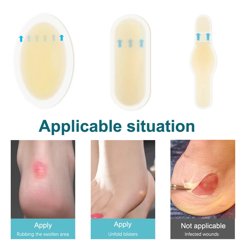 Plâtre de gel hydrocolloïdal adhésif pour ampoules, autocollant de talon anti-usure, patch de pédicure, outils de soin des pieds, 24 pièces, 5 pièces