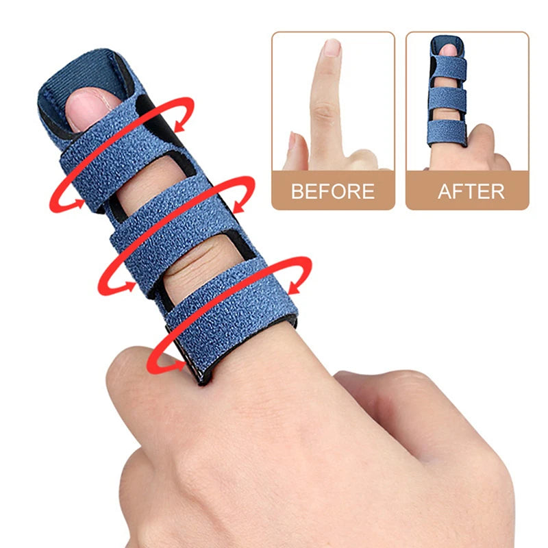 Attelle de doigt, soulagement de la douleur, déclencheur, Support réglable, attelle de fixation, entorse, Llocation, Fracture, correcteur d'attelle de doigt
