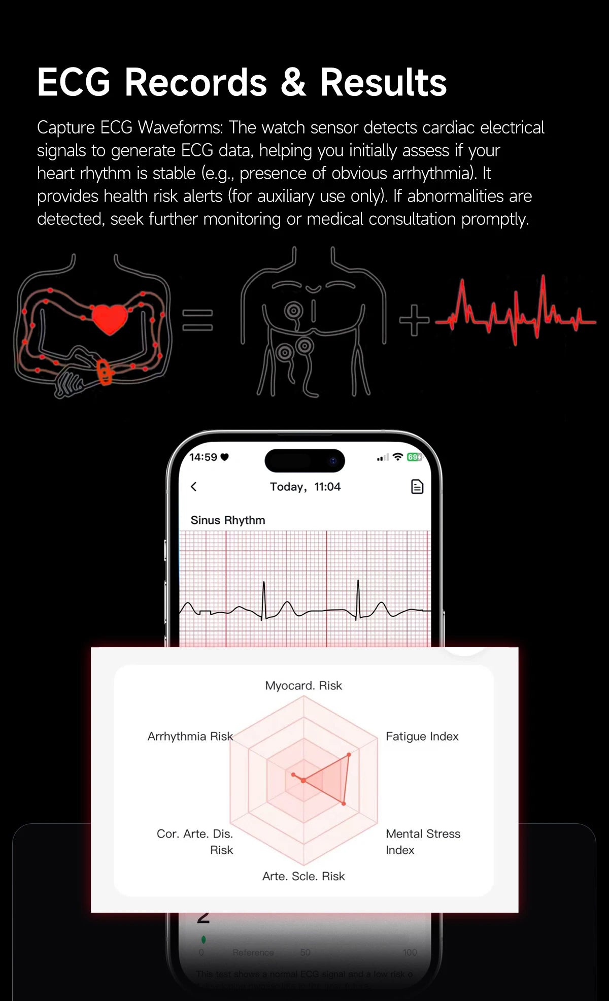 Nouvelle Montre Connectée Ultra-Mince 8mm 2026 pour Femme avec Suivi ECG, Fréquence Cardiaque, Pression Artérielle, Oxygène Sanguin et Appel Bluetooth