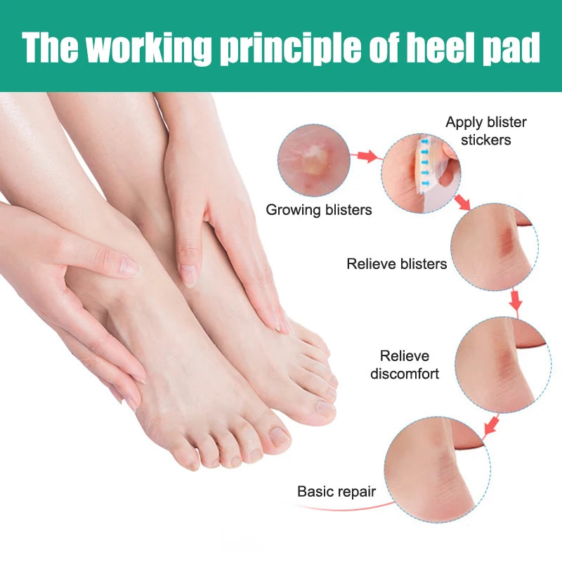 Plâtre de gel hydrocolloïdal adhésif pour ampoules, autocollant de talon anti-usure, patch de pédicure, outils de soin des pieds, 24 pièces, 5 pièces
